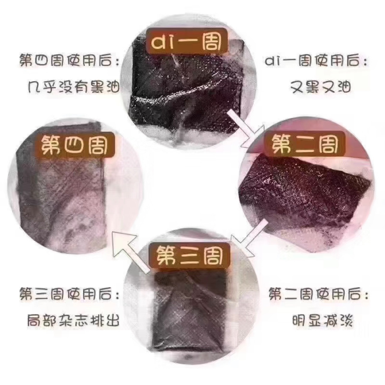 泰國🇹🇭消水腫神奇超猛足貼